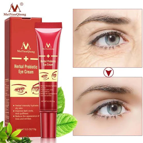 MEIYANQIONG Eye Cream Eye Care Against Puffiness, Dark Circle, Anti-Wrinkle